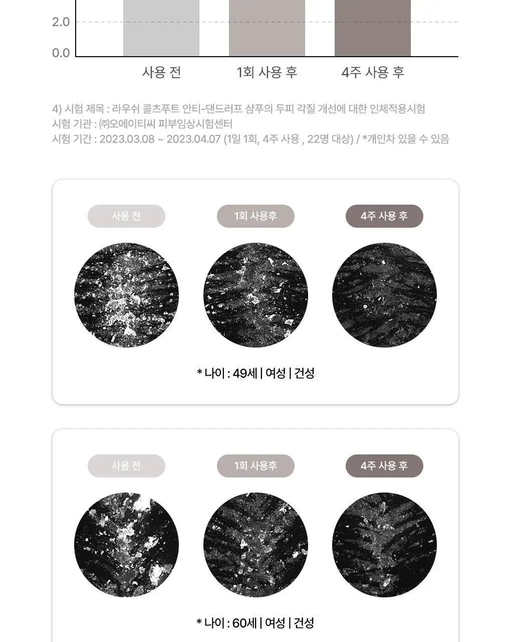 [비듬각질정화SET]라우쉬 콜츠푸트 안티-댄드러프 샴푸200ML&컨디셔너150ML 기획 상세페이지 10